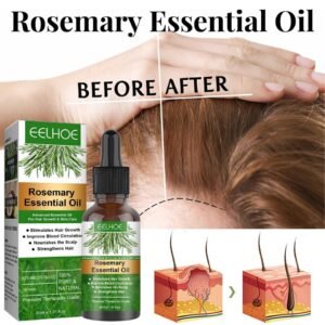 Hair Growth Rose Essential Oil